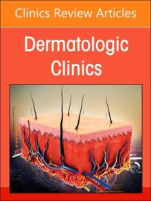 Diversity, Equity, and Inclusion in Dermatology, an Issue of Dermatologic Clinics: Volume 41-2