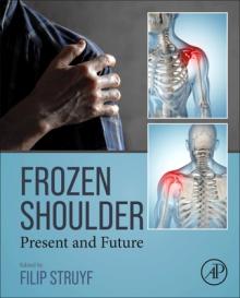 Frozen Shoulder: Present and Future