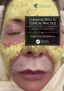 Chemical Peels in Clinical Practice: A Practical Guide to Superficial, Medium, and Deep Peels