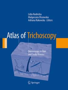 Atlas of Trichoscopy: Dermoscopy in Hair and Scalp Disease