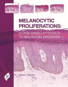 Melanocytic Proliferations