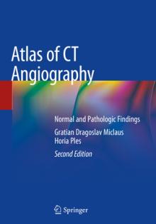 Atlas of CT Angiography: Normal and Pathologic Findings