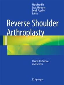 Reverse Shoulder Arthroplasty: Clinical Techniques and Devices