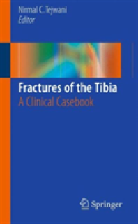Fractures of the Tibia: A Clinical Casebook