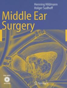 Middle Ear Surgery [With DVD]