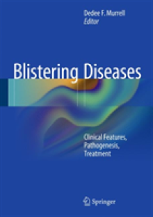 Blistering Diseases: Clinical Features, Pathogenesis, Treatment